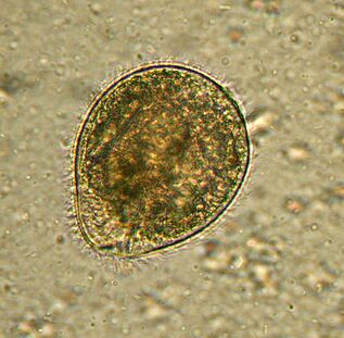 Balantidium est le plus grand parasite protozoaire